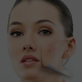 Leczenie przebarwień